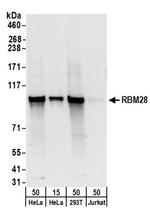 RBM28 Antibody in Western Blot (WB)