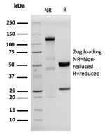 Human Herpes Virus 8 (HHV8) Antibody in SDS-PAGE (SDS-PAGE)