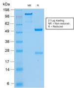 Cytokeratin 8/18 Antibody in SDS-PAGE (SDS-PAGE)