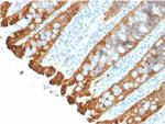 Cytokeratin 8/18 Antibody in Immunohistochemistry (Paraffin) (IHC (P))