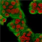 Cytokeratin, Multi (Epithelial Marker) Antibody in Immunocytochemistry (ICC/IF)