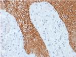 Cytokeratin, Multi (Epithelial Marker) Antibody in Immunohistochemistry (Paraffin) (IHC (P))