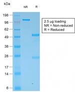 Cytokeratin, Multi (Epithelial Marker) Antibody in SDS-PAGE (SDS-PAGE)