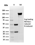 Cytokeratin, Type I (Epithelial Marker) Antibody in SDS-PAGE (SDS-PAGE)