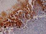 HSV1 (Herpes Simplex Virus Type I) Antibody in Immunohistochemistry (Paraffin) (IHC (P))