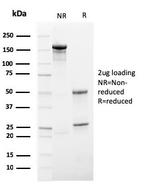 HSV1 (Herpes Simplex Virus Type I) Antibody in Immunoelectrophoresis (IE)