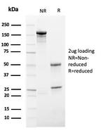 HSV1 (Herpes Simplex Virus Type I) Antibody in SDS-PAGE (SDS-PAGE)