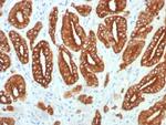 Cytokeratin, Type I (Epithelial Marker) Antibody in Immunohistochemistry (Paraffin) (IHC (P))