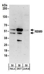 RBM9 Antibody in Western Blot (WB)