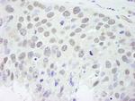 RBM9 Antibody in Immunohistochemistry (IHC)