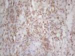 RBMS1 Antibody in Immunohistochemistry (Paraffin) (IHC (P))