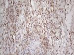 RBMS1 Antibody in Immunohistochemistry (Paraffin) (IHC (P))