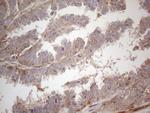 RBMS1 Antibody in Immunohistochemistry (Paraffin) (IHC (P))