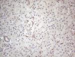 RBMS1 Antibody in Immunohistochemistry (Paraffin) (IHC (P))