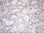 RBMS1 Antibody in Immunohistochemistry (Paraffin) (IHC (P))