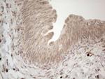 RBMS1 Antibody in Immunohistochemistry (Paraffin) (IHC (P))