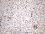 RBMS1 Antibody in Immunohistochemistry (Paraffin) (IHC (P))