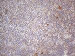 RBMS1 Antibody in Immunohistochemistry (Paraffin) (IHC (P))