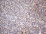 RBMS1 Antibody in Immunohistochemistry (Paraffin) (IHC (P))