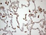 RBMS1 Antibody in Immunohistochemistry (Paraffin) (IHC (P))