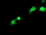 RBP1 Antibody in Immunocytochemistry (ICC/IF)