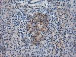 RBP1 Antibody in Immunohistochemistry (Paraffin) (IHC (P))