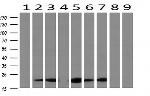 RBP1 Antibody in Western Blot (WB)