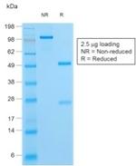 HSV1 (Herpes Simplex Virus Type I) Antibody in SDS-PAGE (SDS-PAGE)