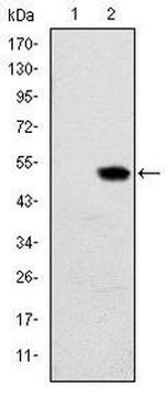 RBP4 Antibody in Western Blot (WB)