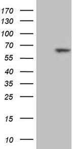 RBPJ Antibody in Western Blot (WB)