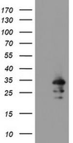 RBPMS Antibody in Western Blot (WB)