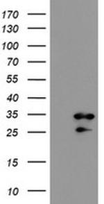 RBPMS Antibody in Western Blot (WB)