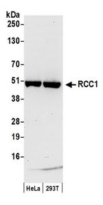 RCC1 Antibody in Western Blot (WB)