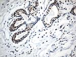 RCOR1 Antibody in Immunohistochemistry (Paraffin) (IHC (P))