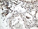 RCOR1 Antibody in Immunohistochemistry (Paraffin) (IHC (P))