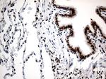 RCOR1 Antibody in Immunohistochemistry (Paraffin) (IHC (P))