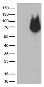 RCOR1 Antibody in Western Blot (WB)