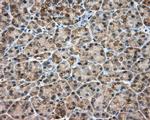 RDH11 Antibody in Immunohistochemistry (Paraffin) (IHC (P))