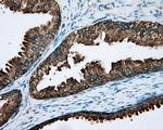 RDH11 Antibody in Immunohistochemistry (Paraffin) (IHC (P))