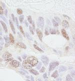 REA Antibody in Immunohistochemistry (IHC)