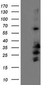 REEP2 Antibody in Western Blot (WB)