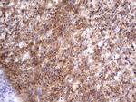 RELA Antibody in Immunohistochemistry (Paraffin) (IHC (P))