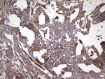 RELA Antibody in Immunohistochemistry (Paraffin) (IHC (P))