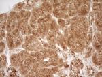 REN Antibody in Immunohistochemistry (Paraffin) (IHC (P))