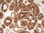 REN Antibody in Immunohistochemistry (Paraffin) (IHC (P))