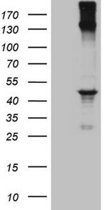 REN Antibody in Western Blot (WB)