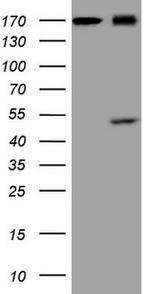 REN Antibody in Western Blot (WB)