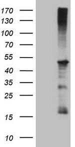 REN Antibody in Western Blot (WB)