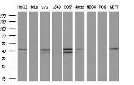 REN Antibody in Western Blot (WB)