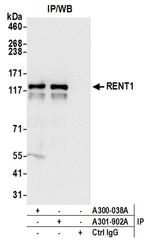 RENT1 Antibody in Western Blot (WB)